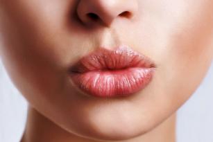 Masking cold sores on the lips Is it possible to cover herpes with concealer